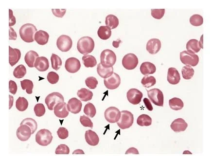 Lab Notes: The Iron Panel - What Your Results Actually Mean