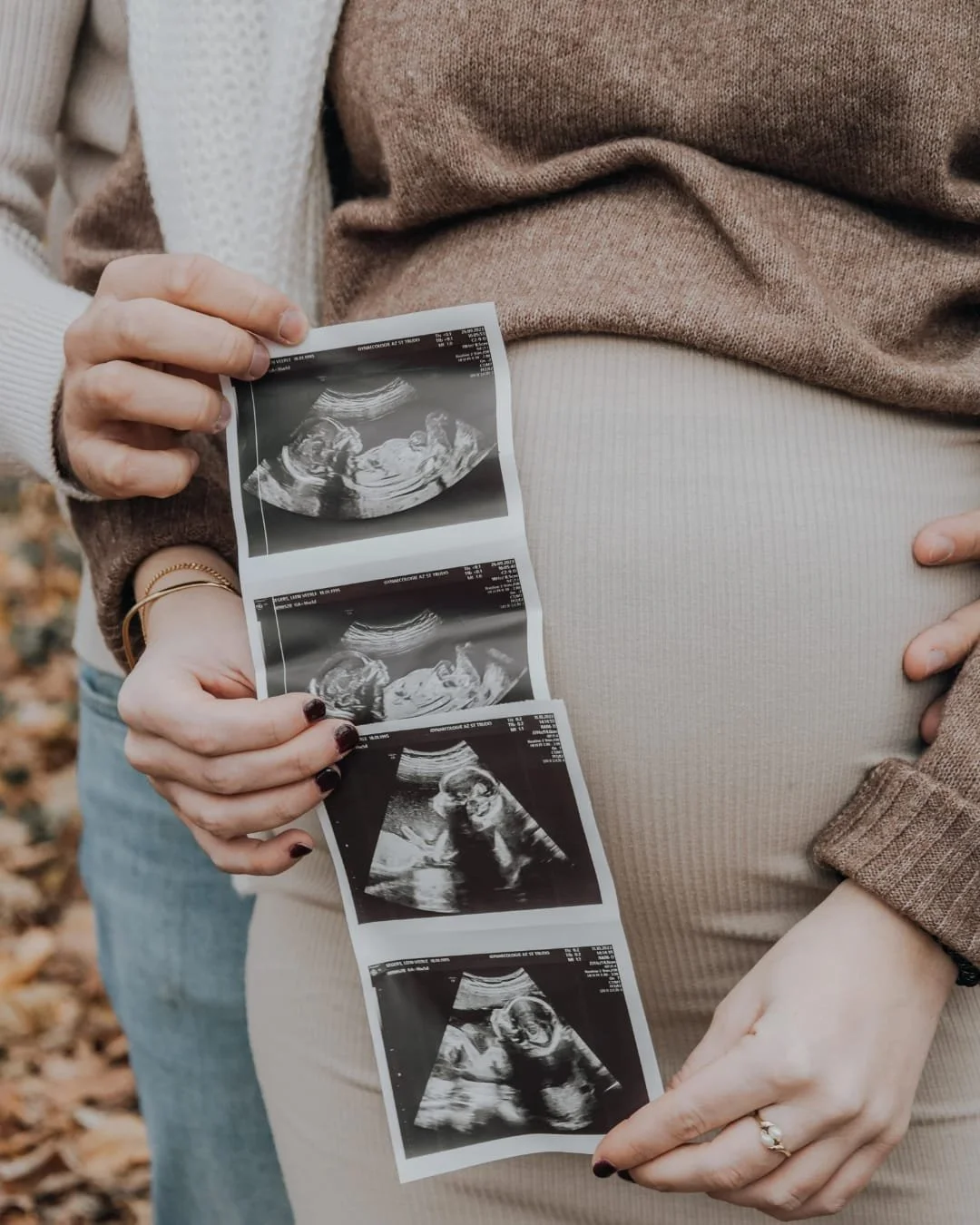 Una donna incinta tiene un'ecografia del suo bambino vicino al pancione. Un'altra persona mette la mano sulla pancia. L'immagine è in modo naturale, con foglie sullo sfondo.