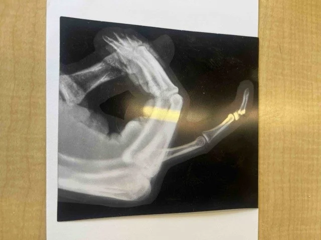 Brokenfinger_sports Medium.jpeg