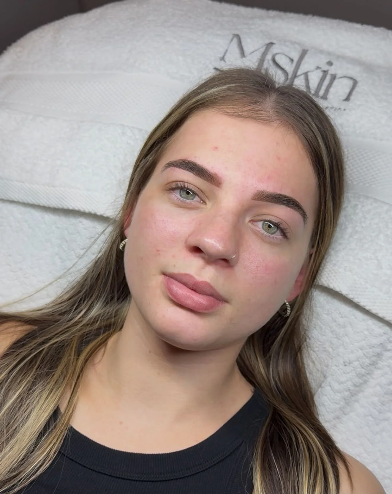 A woman lying on a massage table with her eyes closed, surrounded by spa equipment, with a handheld device on her abdomen and a machine nearby that appears to be used for a treatment.