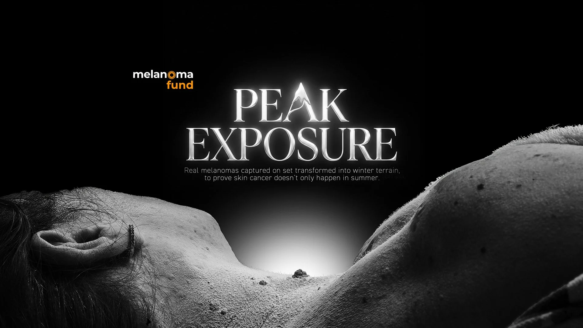 Melanoma Fund launch “Peak Exposure” exhibition for UK’s Mountain Training Professionals 