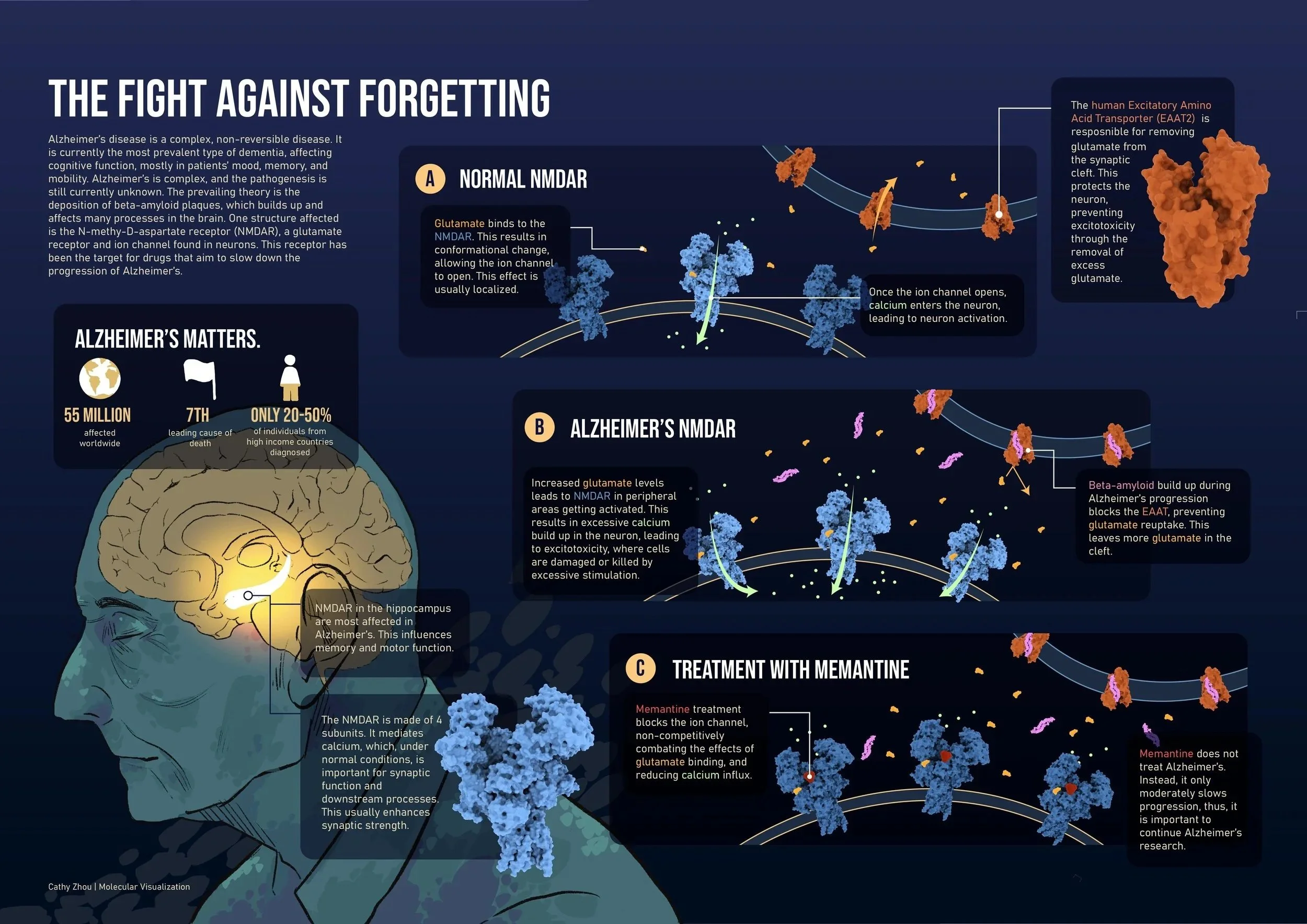 An infographic about Alzheimer's disease, illustrating the fight against forgetting with sections on normal NMDA receptor function, Alzheimer's NMDA receptor dysfunction, treatment with memantine, and the impact of the disease on the brain. Visuals i