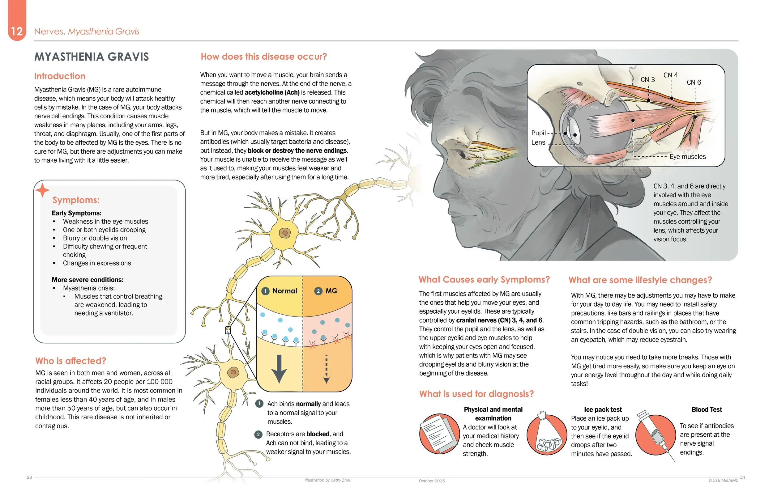 Diagram of the eye muscles showing nerve connections with labels for the pupil, lens, eye muscles, and nerve pathways. An illustration of a person’s head in profile with scientific annotations about nerve signals and muscle responses related to eye m