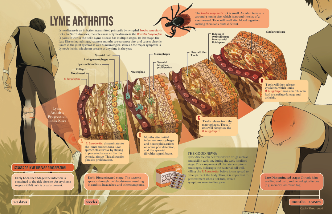 An infographic explaining Lyme arthritis progression, showing stages from early localized infection to late stage with joint swelling and neurological issues. Includes illustrations of tick biology and immune response, and a person sitting with a kne