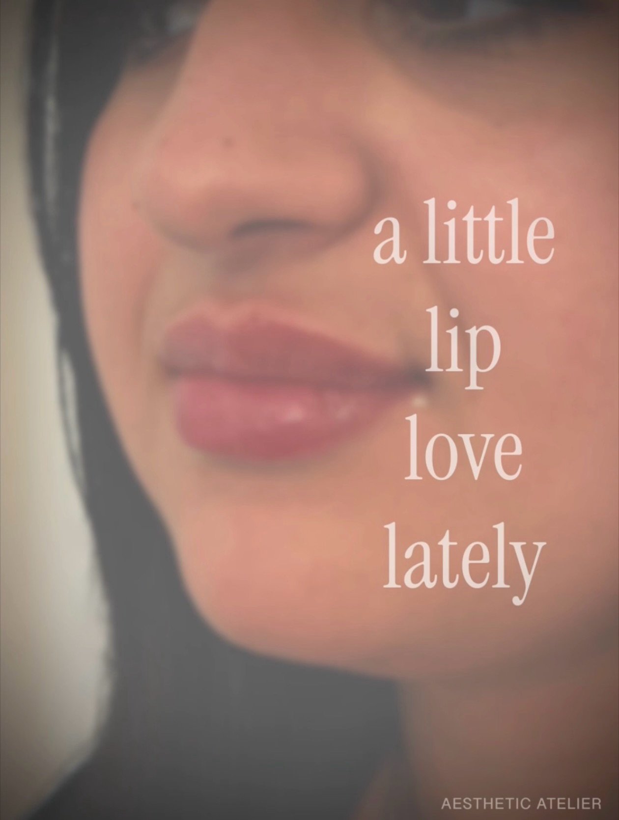 We&rsquo;ve been busy around here lately&hellip; including a little lip love 👄✨

Some recent faves&hellip; 
Subtle volume, soft structure, and results that still feel like you, just refreshed.

Always customized based on your natural anatomy and goa
