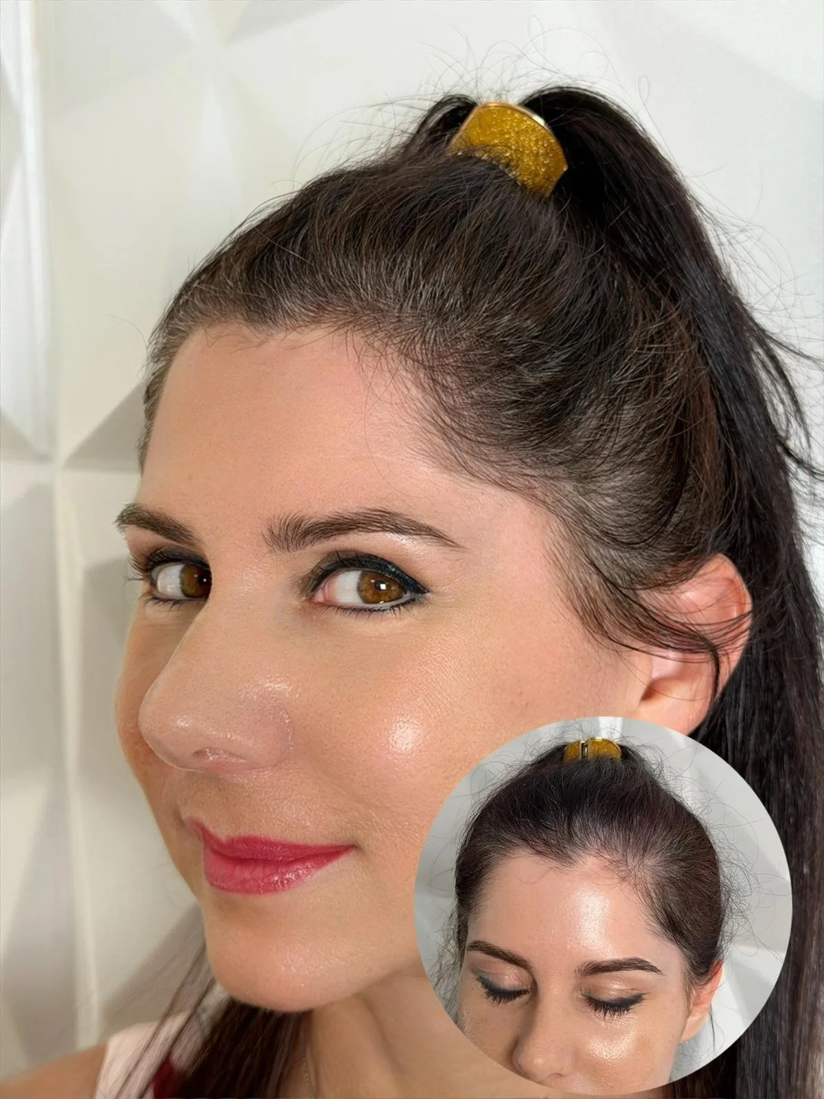 Einzelhaarzeichnung mit HeadSkin Coloring im Signature-Seminar zur natürlichen Rekonstruktion der Haarlinie