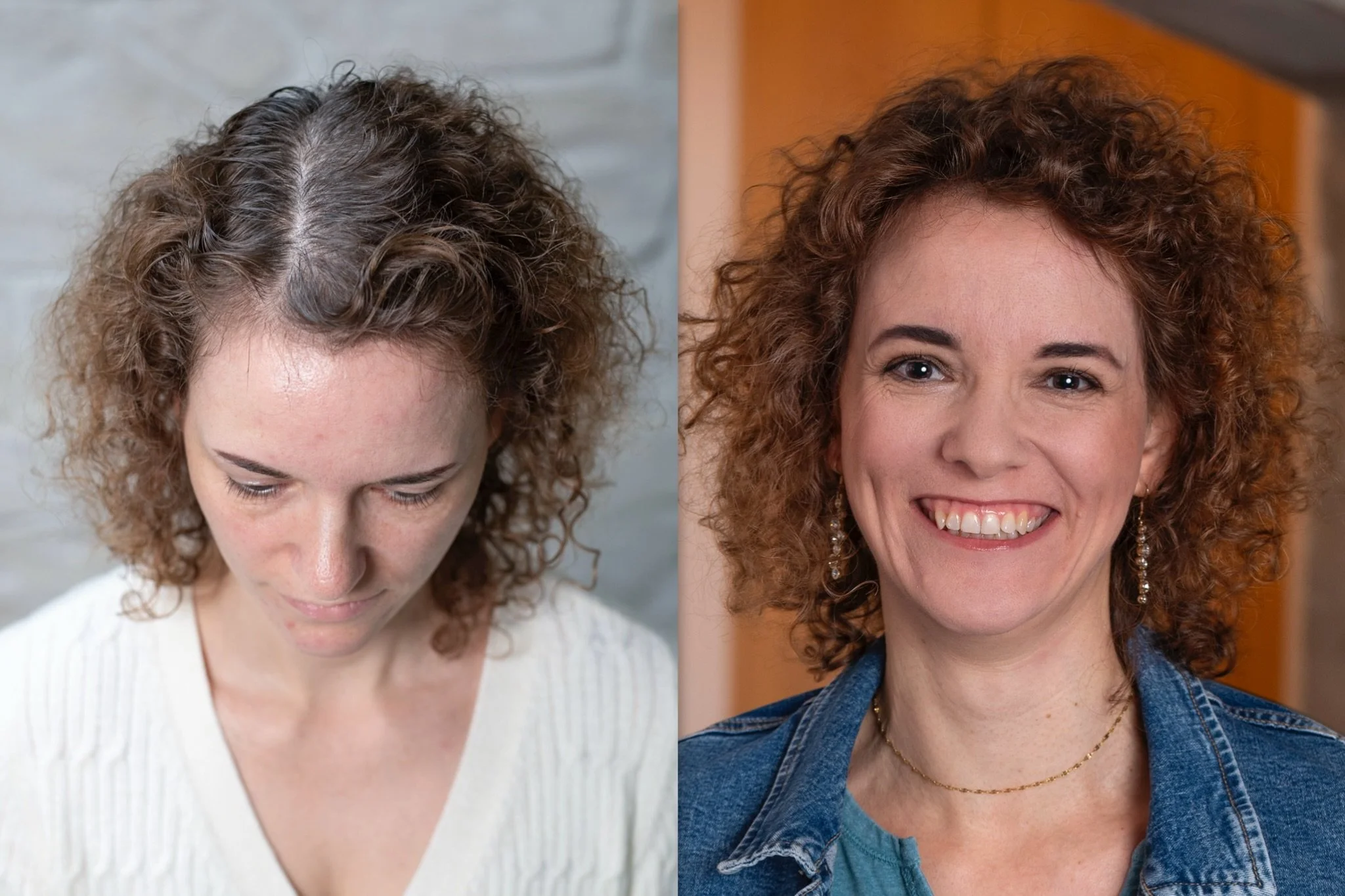 Vorher-Nachher-Bild einer Frau mit breitem Scheitel, links sichtbar ausgedünnter Scheitelbereich, rechts optisch verdichteter und geschlossener Oberkopf durch HeadSkin Coloring.