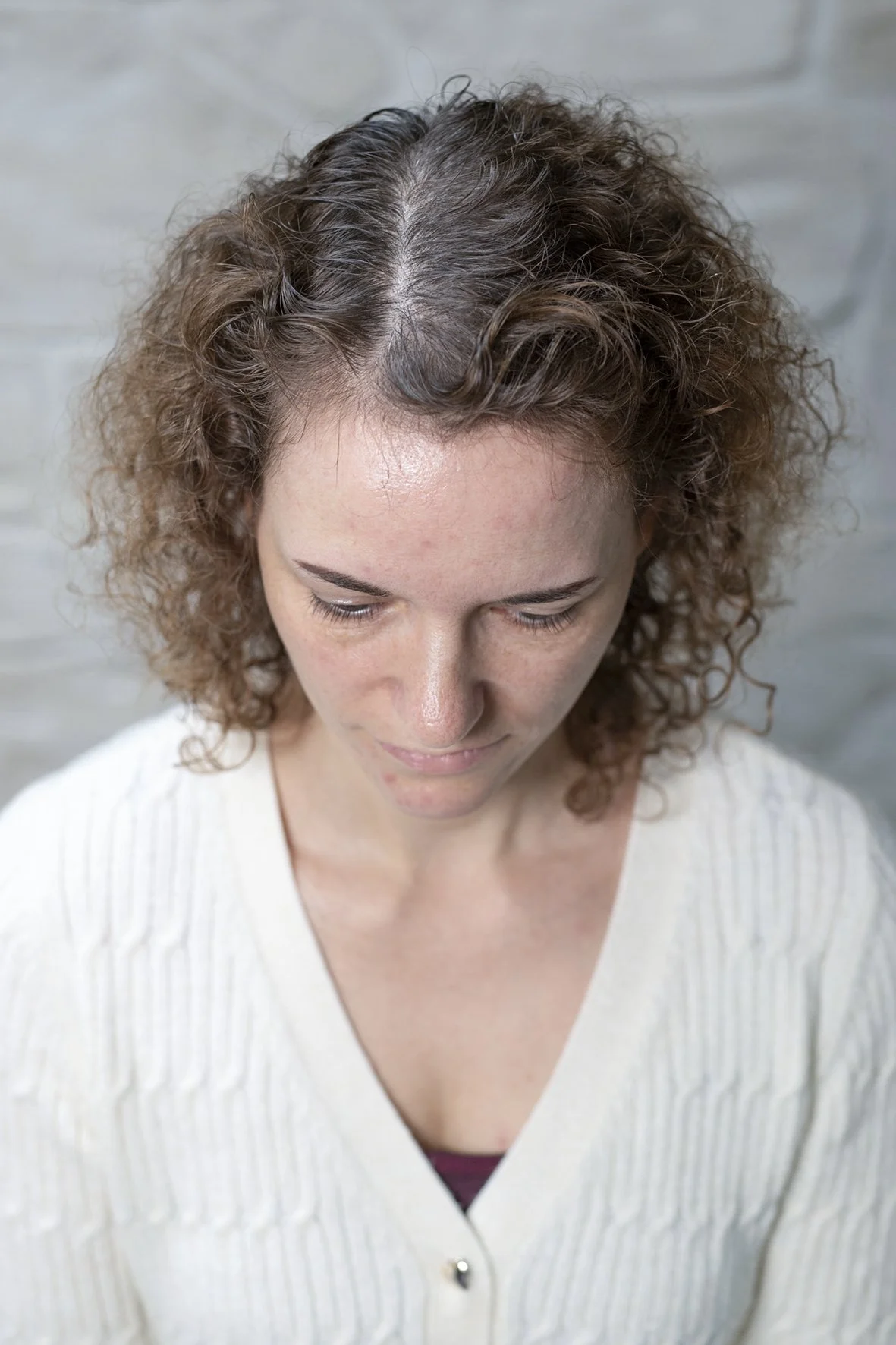 Dieselbe Frau nach HeadSkin Coloring, der Scheitel wirkt optisch dichter und gleichmäßiger, die Kopfhaut ist weniger sichtbar.