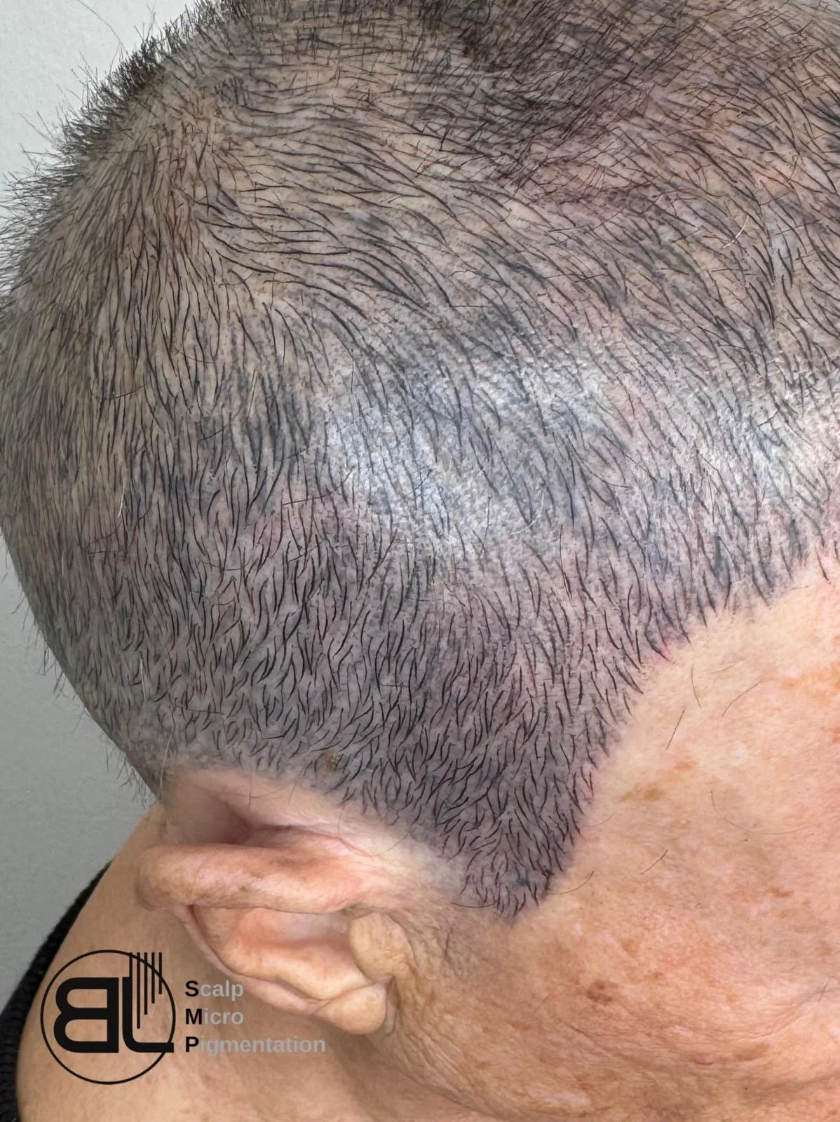 Pixel Hairline Work mit HeadSkin Coloring für natürliche Haarlinie bei Männerhaarschnitt in Detailaufnahme