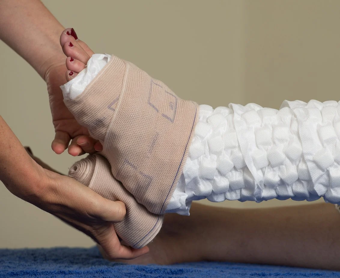 Understanding Lymphedema