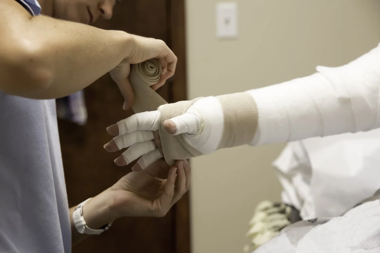 Complete Decongestive Therapy (CDT): The Gold Standard for Lymphedema Treatment