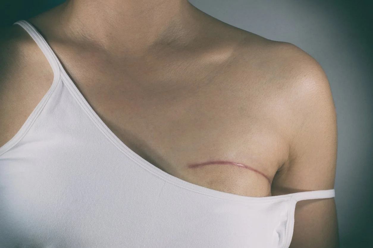 Reconnecting With Your Body After Breast Reconstruction