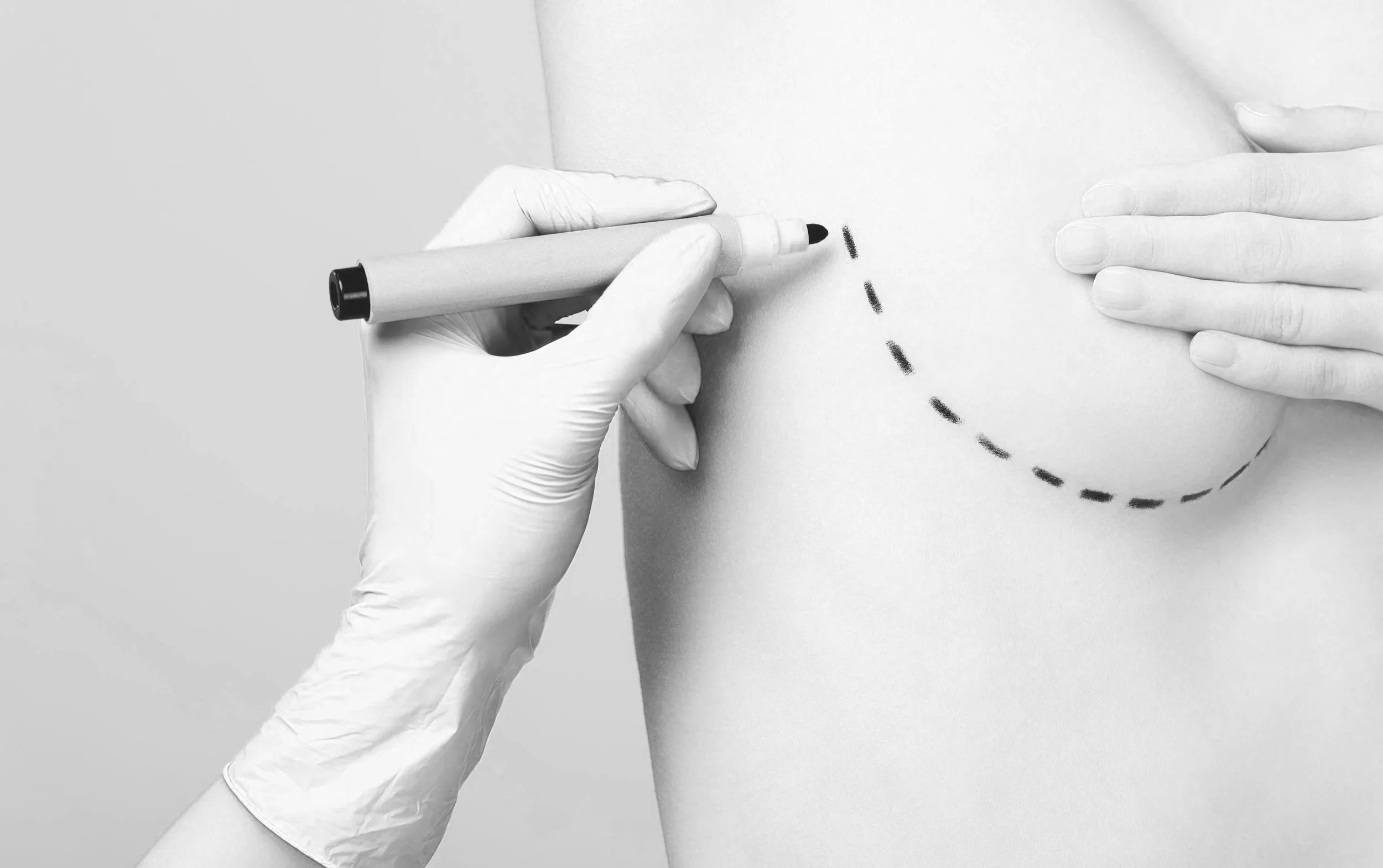 patient prepping for cosmetic surgery