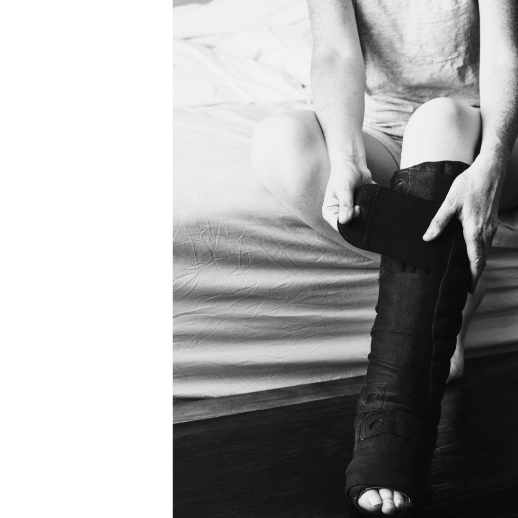 Complete decongestive therapy CDT for lymphedema management New York City