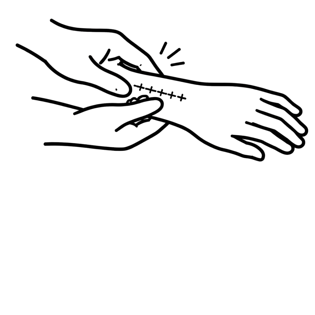 manual scar mobilizations NYC