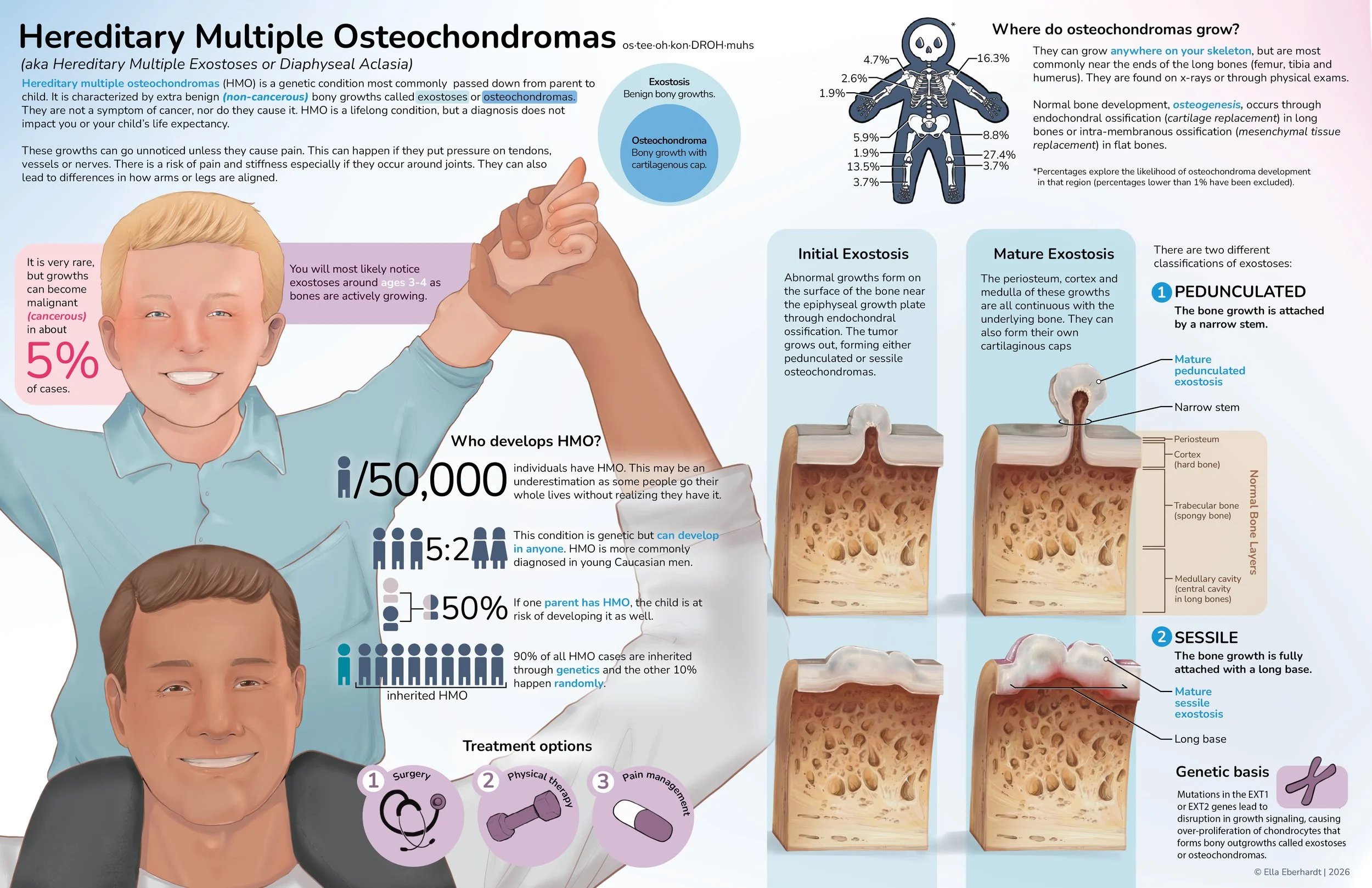 Hereditary Multiple Osteochondromas