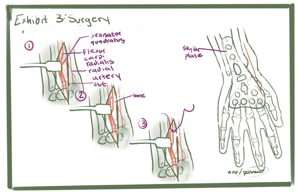 Wrist Case Study - Exhibit 3 Draft