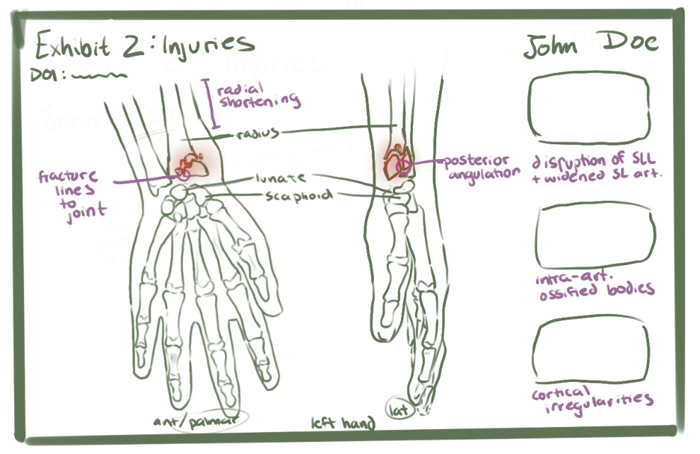 Wrist Case Study - Exhibit 2 Draft
