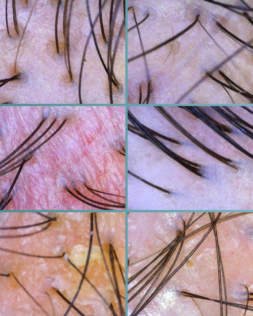Close-up images of human scalp and hair follicles with varying hair density, skin, and scalp conditions.
