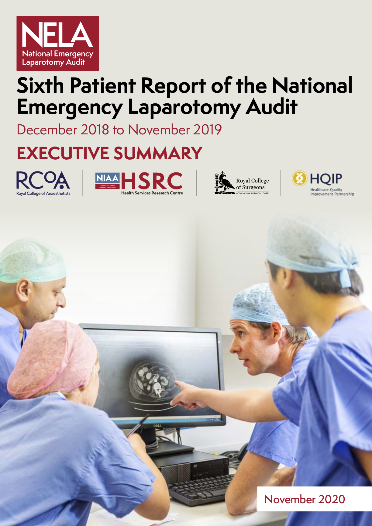 Group of surgeons in scrubs and caps gathered around a computer monitor, with a medical scan displayed on the screen, during a medical discussion or consultation.