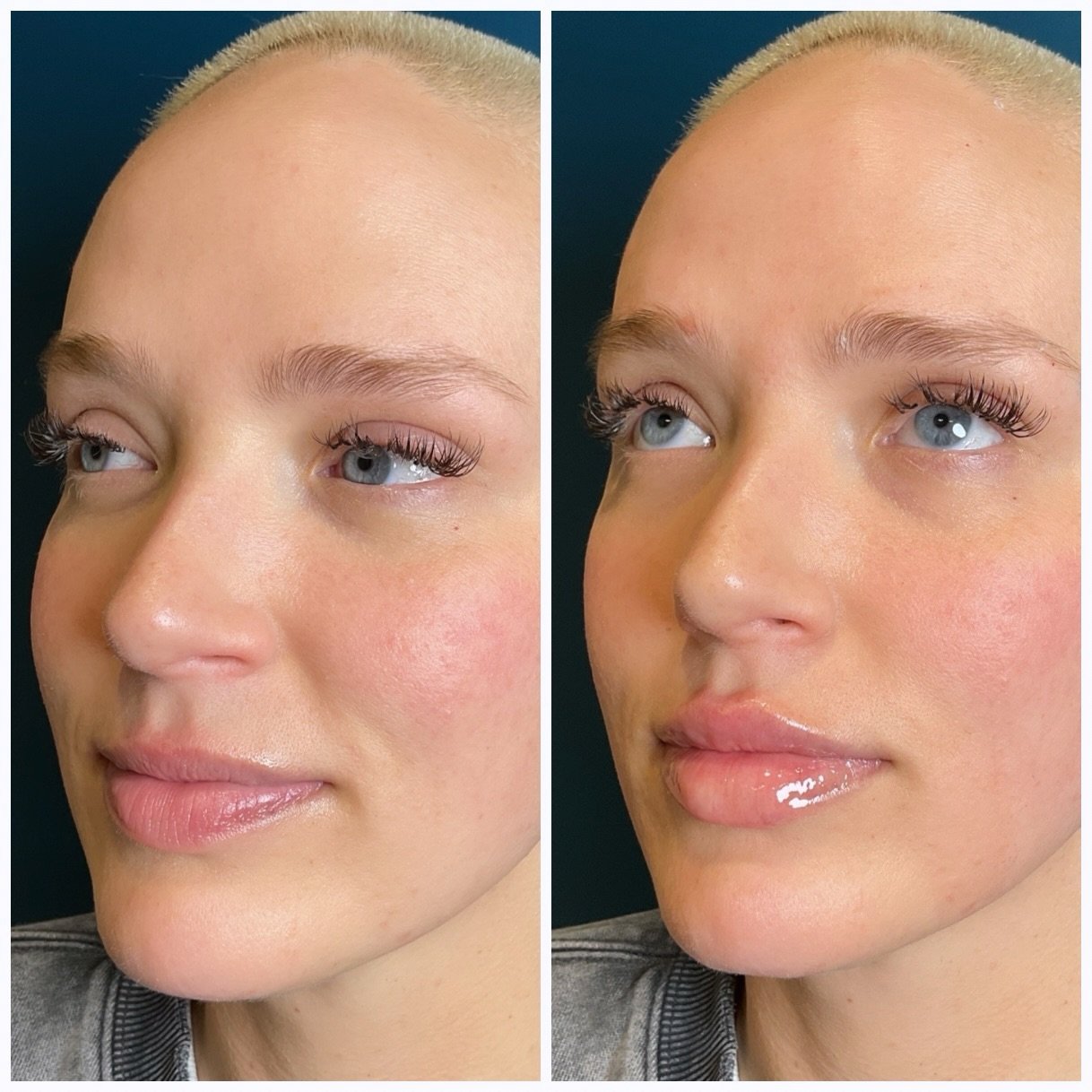 Caption this 😮&zwj;💨 

Beautifully hydrated lips for a beautiful woman ❤️

✨Revanesse Cupid&rsquo;s Bow Lip Filler 
✨Special savings February 7th at event and for those that can&rsquo;t make it all specials will be available for booking online Febr