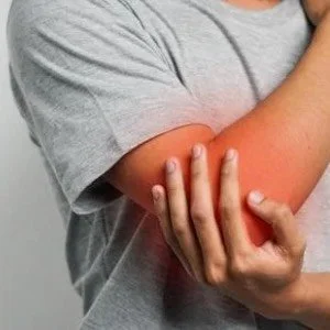 Person holding their elbow, showing redness and possible pain or irritation.