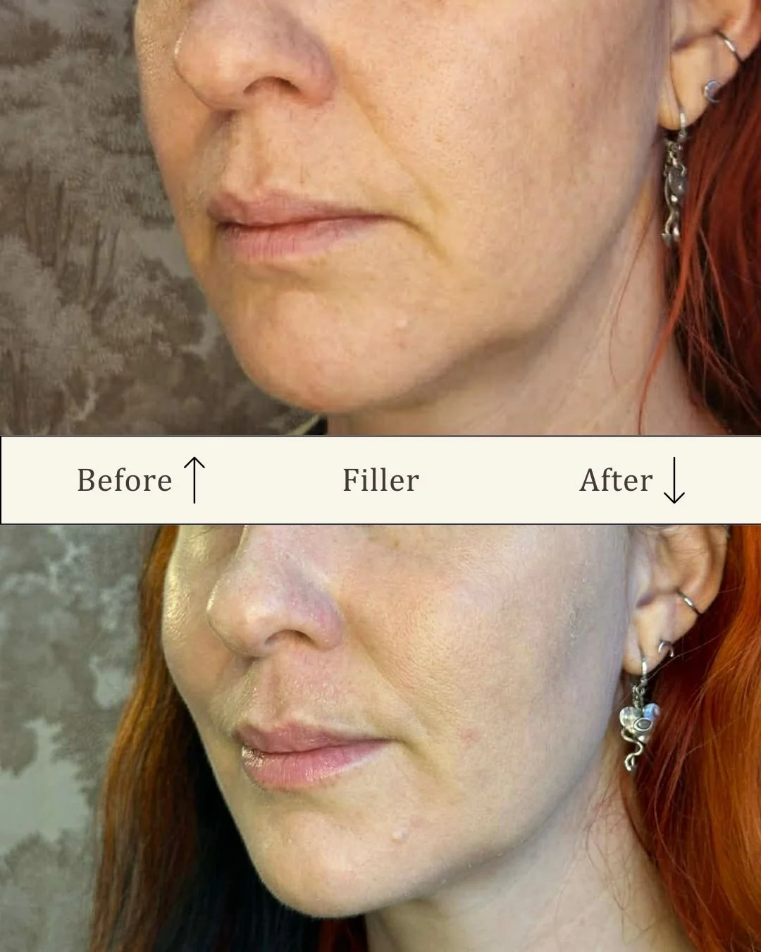 Filler i hagen 2.jpg