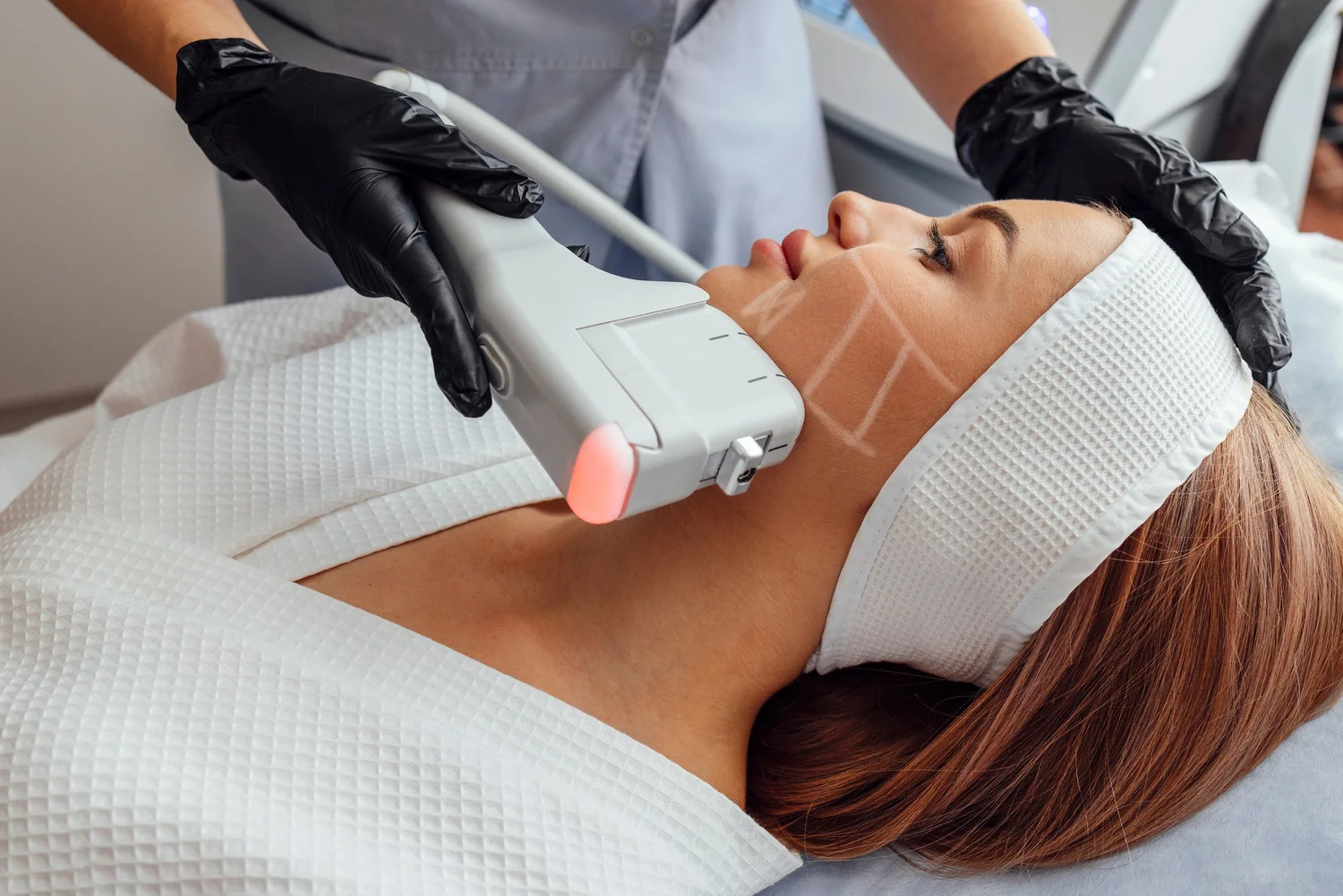 Non-surgical face and neck lift treatment in Fredericksburg, VA