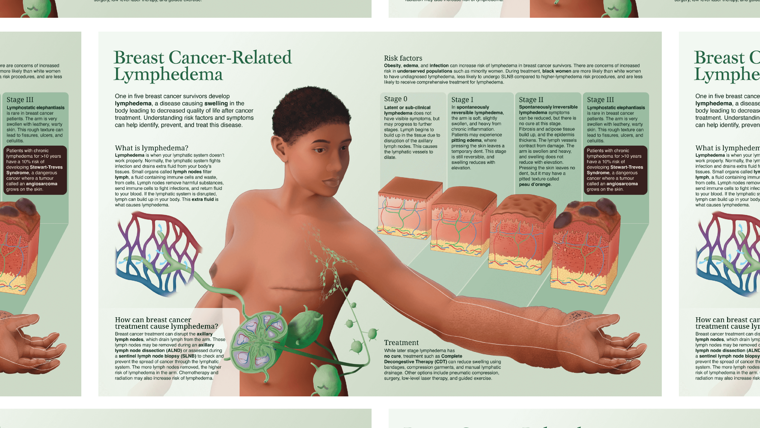 Pathology infographic