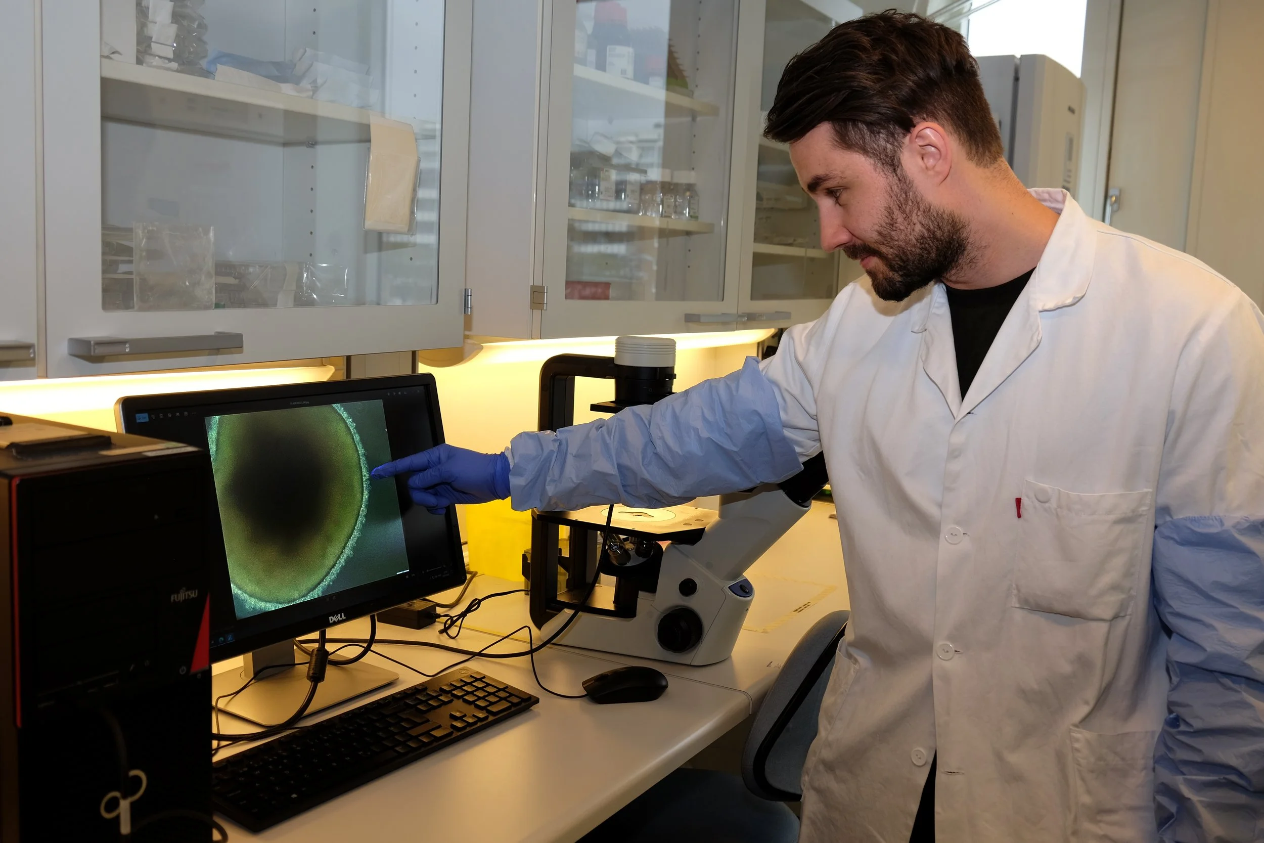 Hvordan lager vi stamceller fra pasienter i laboratoriet?