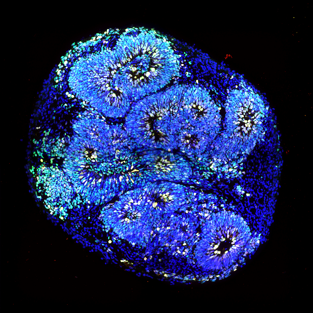 Å se det usynlige: slik visualiserer vi celler og strukturer i organoider