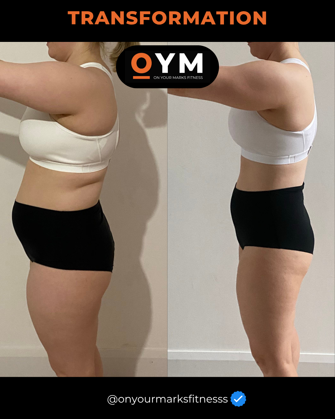 Side-by-side before and after photos of a woman's torso, showing weight loss and body transformation. She is wearing a white sports bra and black shorts in both images.