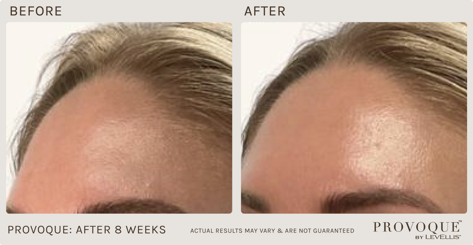Provoque results after 8 weeks. 