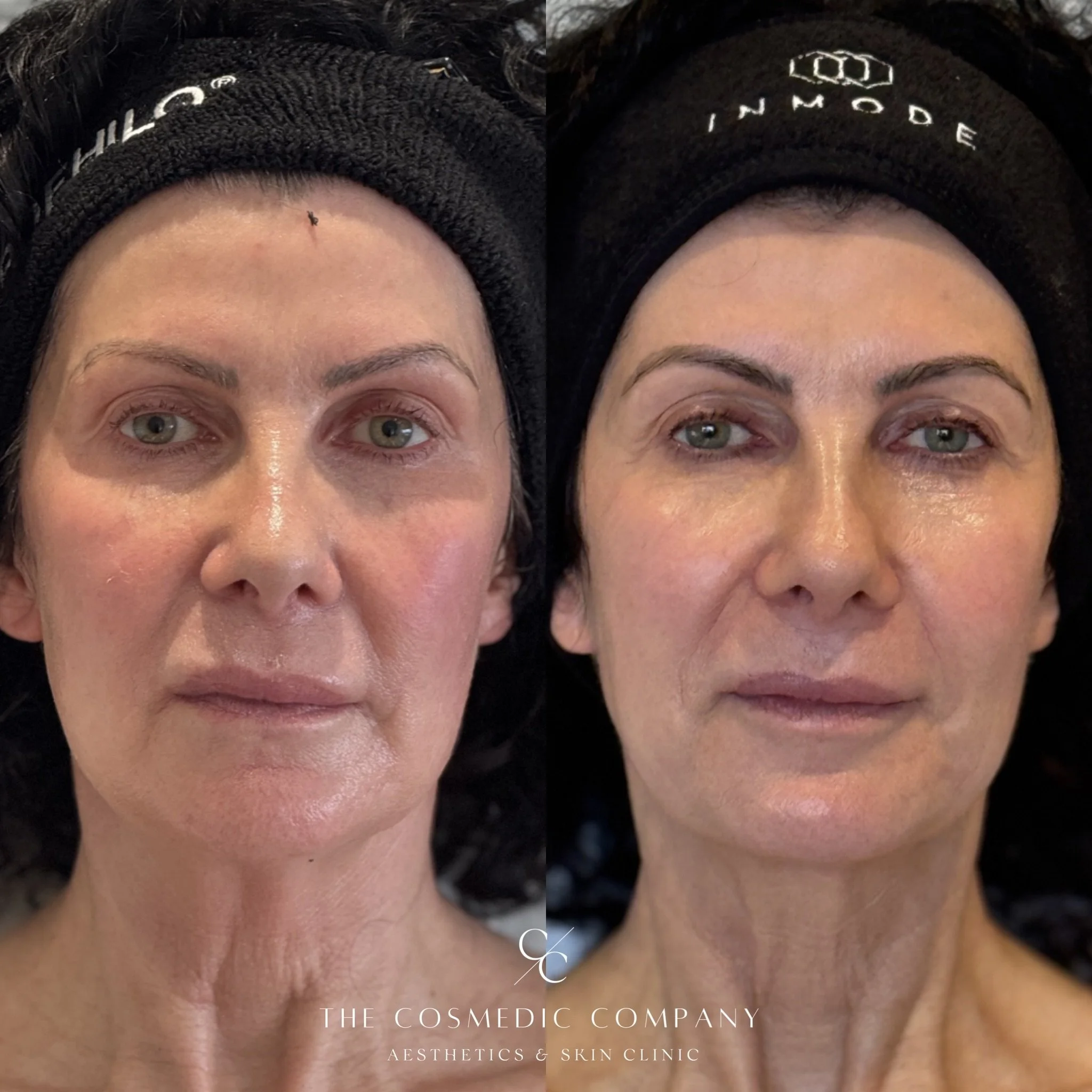 eZy Watermark_06-10-2025_15-31-29-5770.jpeg