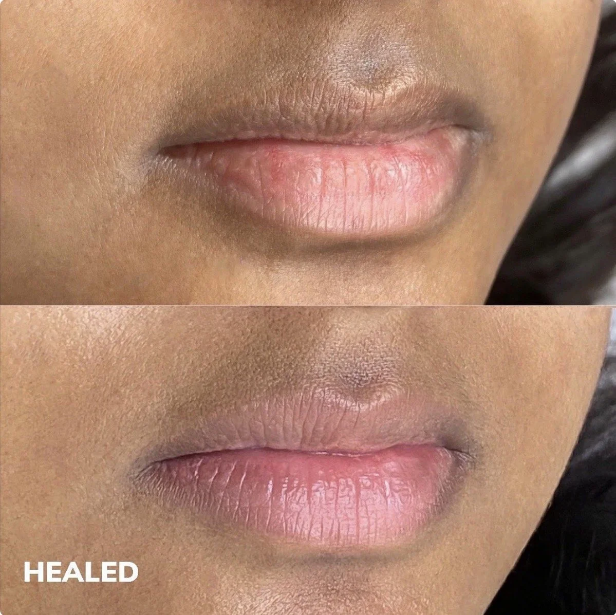 Lip pigmentation