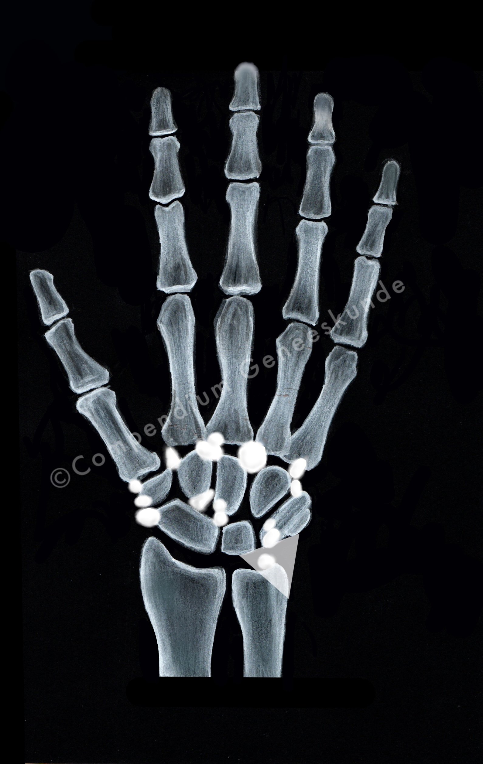 Lokaties_van_accesoire_ossicles_Hand_-_(Blanco).jpg