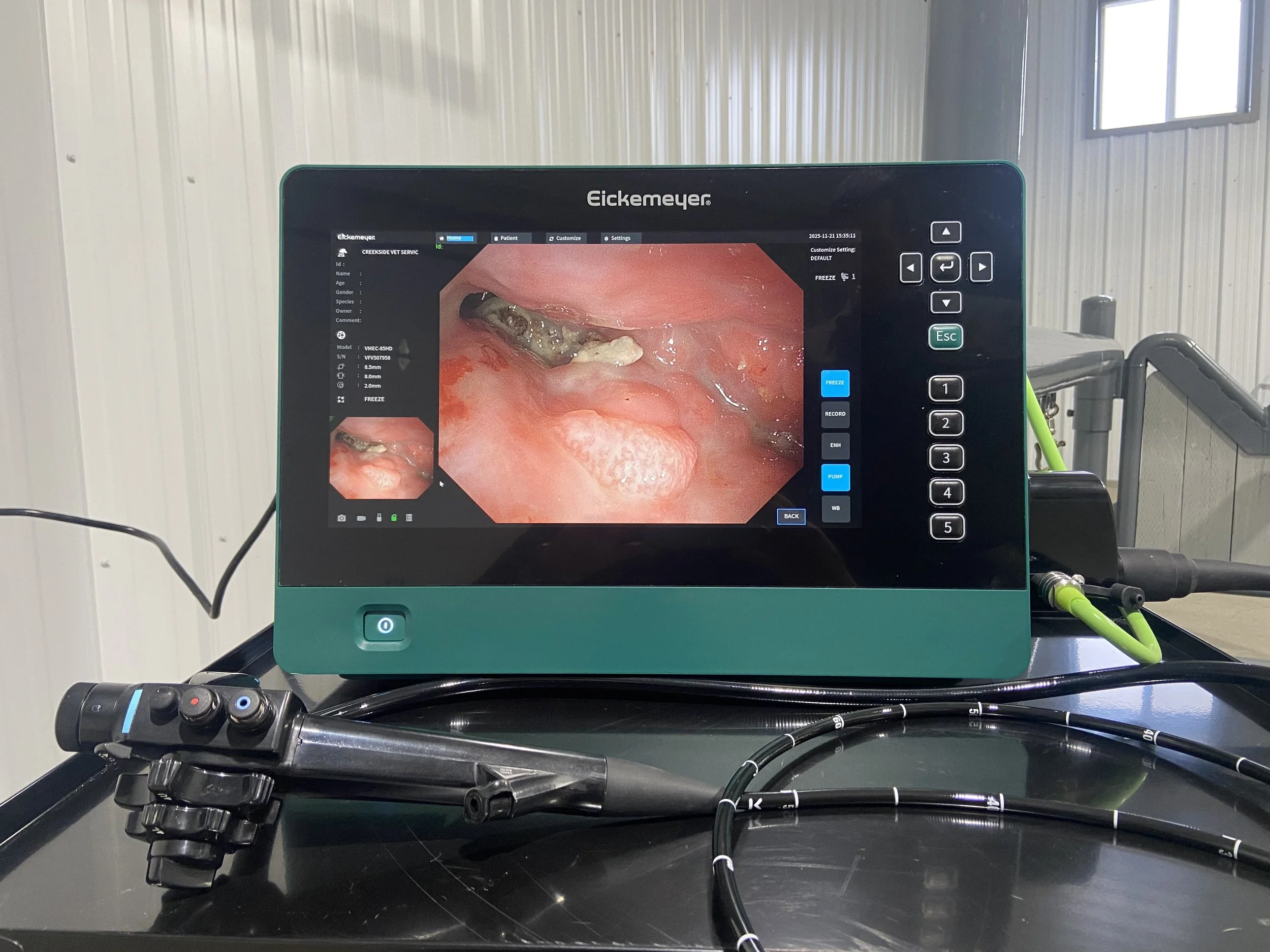 EickView 5 in 1 Endoscopy System