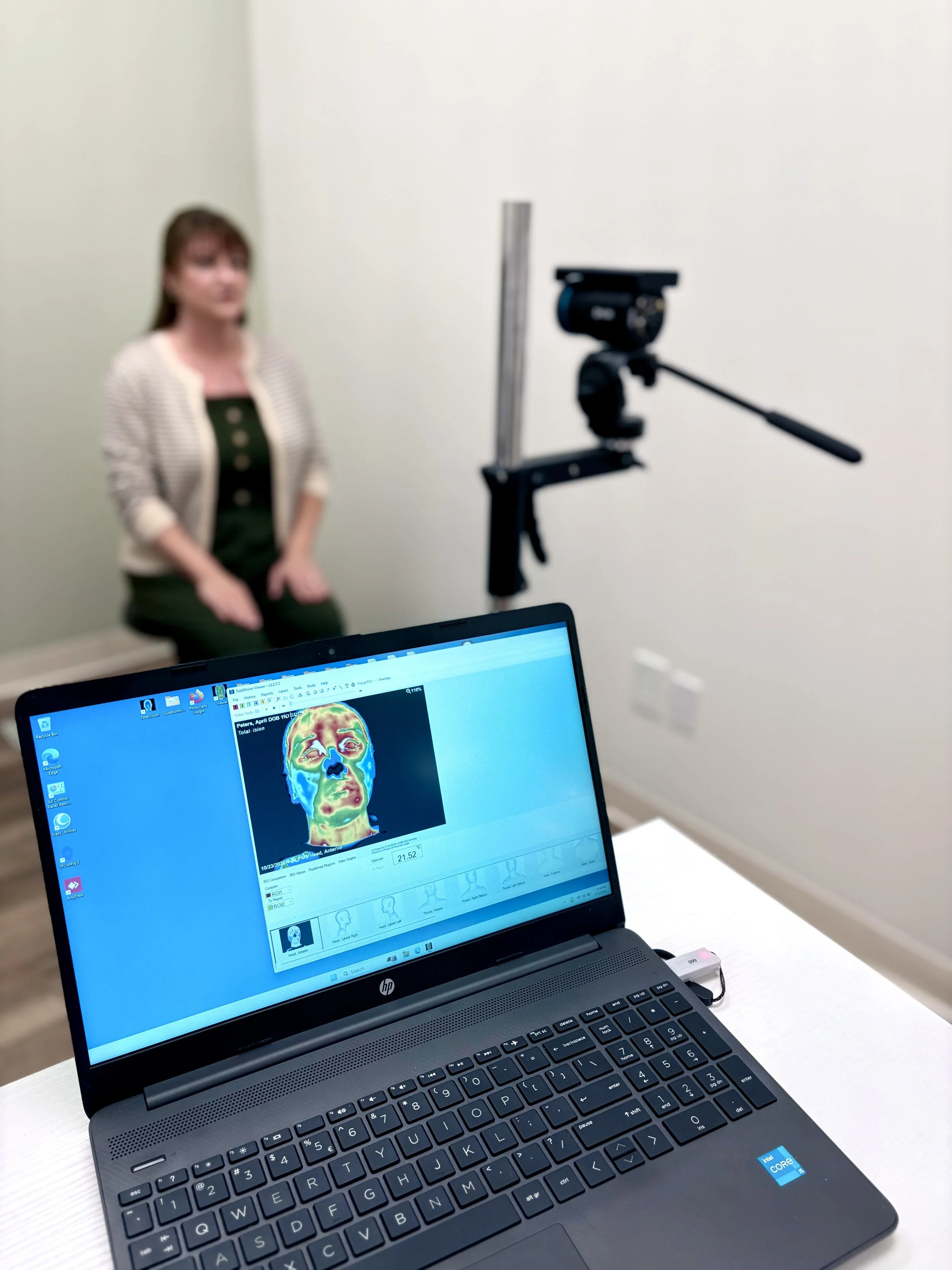 A black laptop displaying a thermal image of a human face on its screen, situated on a white table. In the background, a blurred woman with brown hair, wearing a striped shirt, is sitting against a light-colored wall with a camera on a tripod pointed towards her.