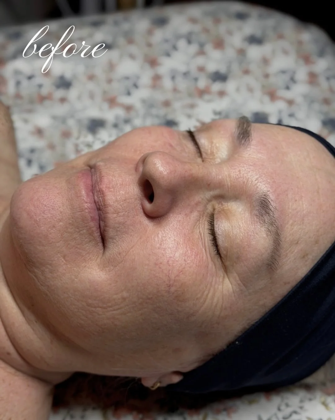 Refreshed, glowy skin 🤍🫧

After this custom treatment, my clients skin is visibly brighter and hydrated 🪞 brighten dull, winter skin with my Afterglow Custom Facial ✨ 

Booking link in bio 🫧

#holisticesthetician #glymedplus #albanyesthetician #g