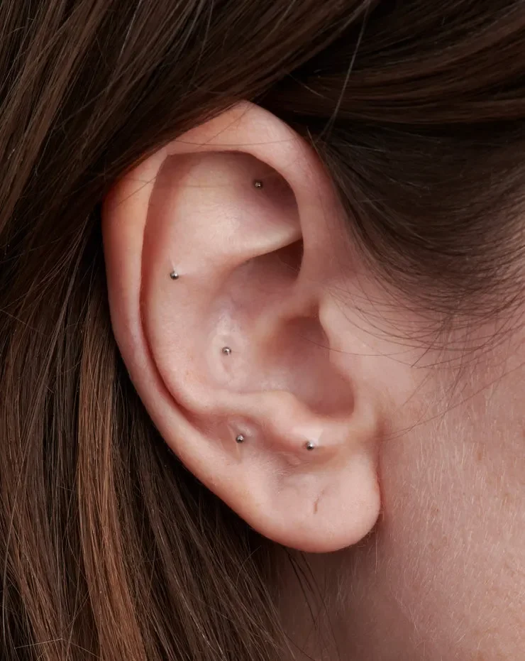 Ear Seeds Acupuncture Services London Ontario