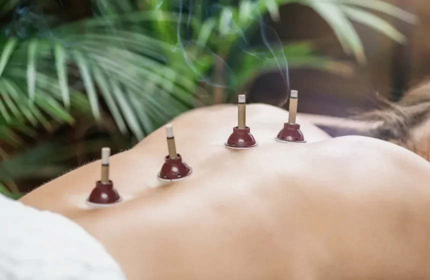 Acupuncture Services London Ontario
