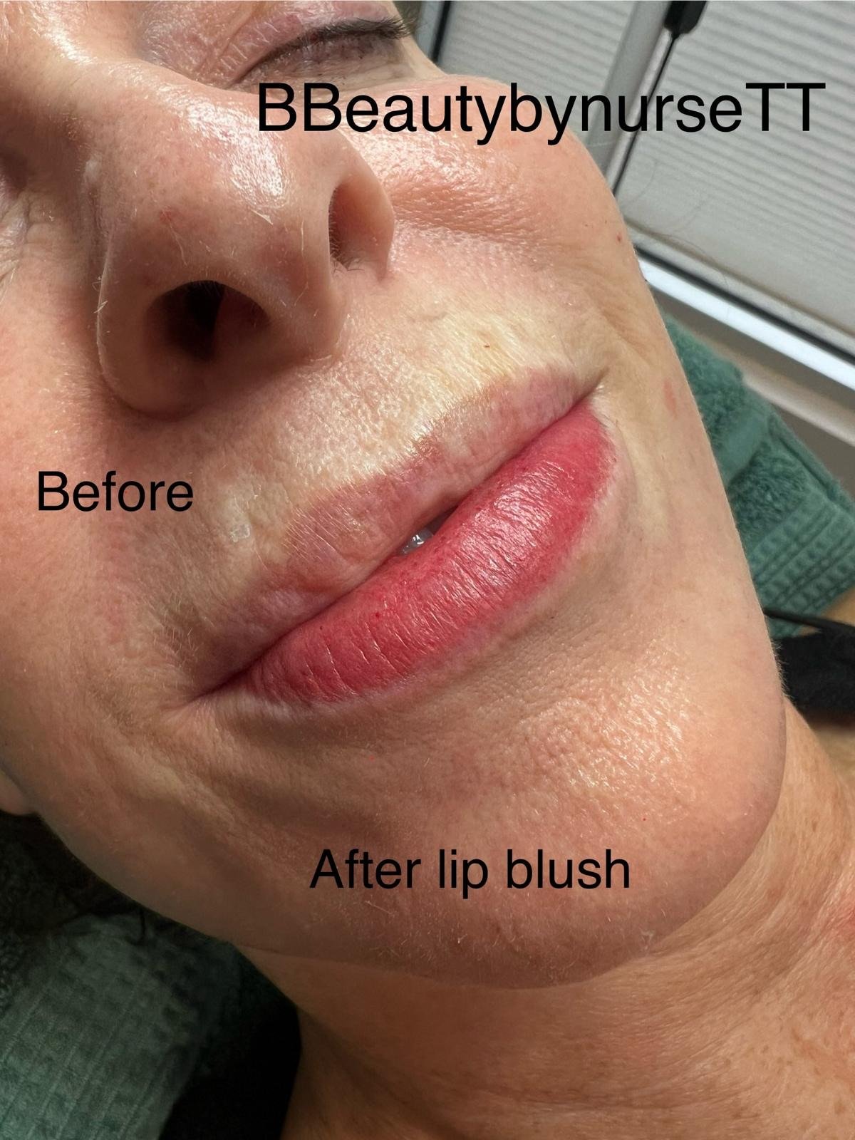 Lip Tattoo: Before & After