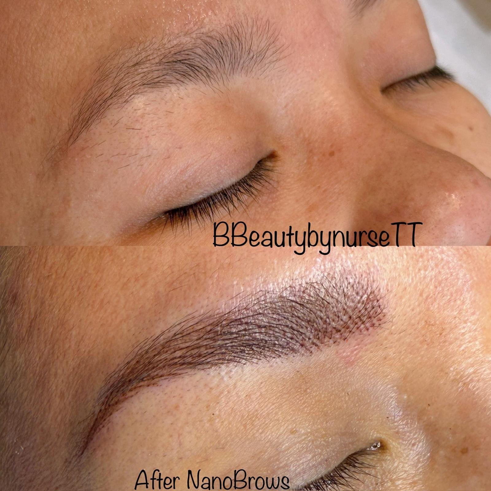 Eyebrow Tattoo: Before & After
