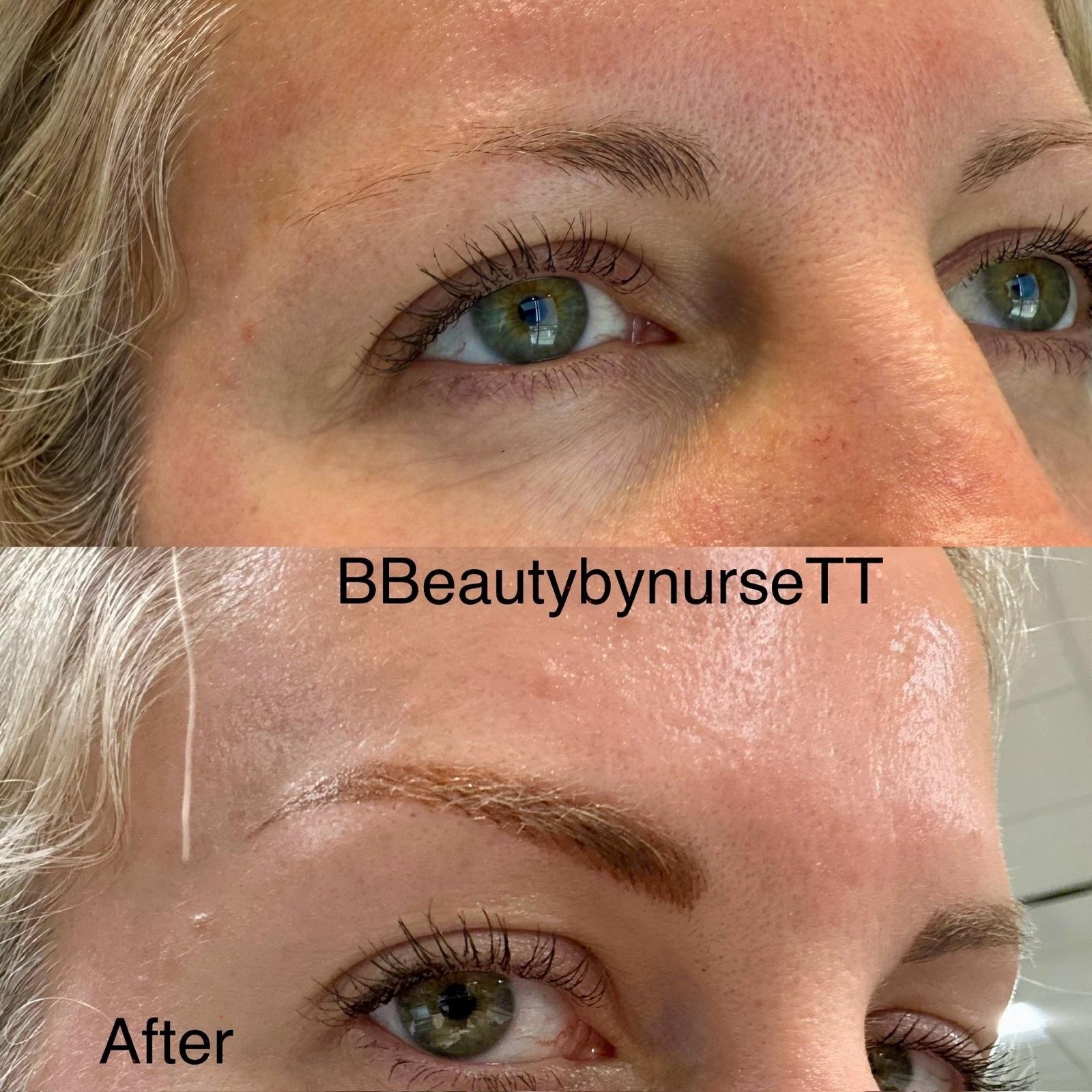 Eyebrow Tattoo: Before & After
