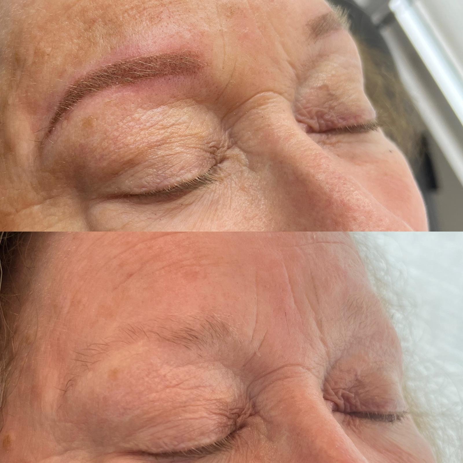 Eyebrow Tattoo: Before & After