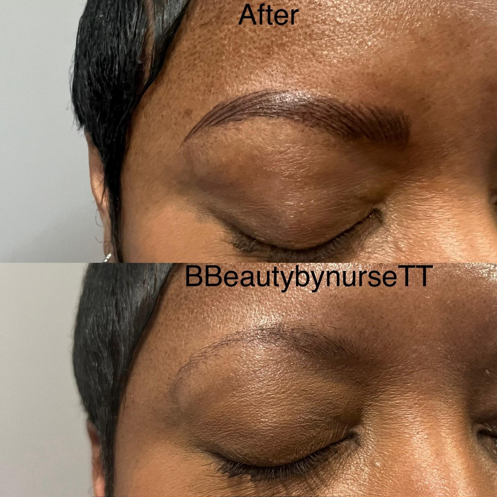 Eyebrow Tattoo: Before & After