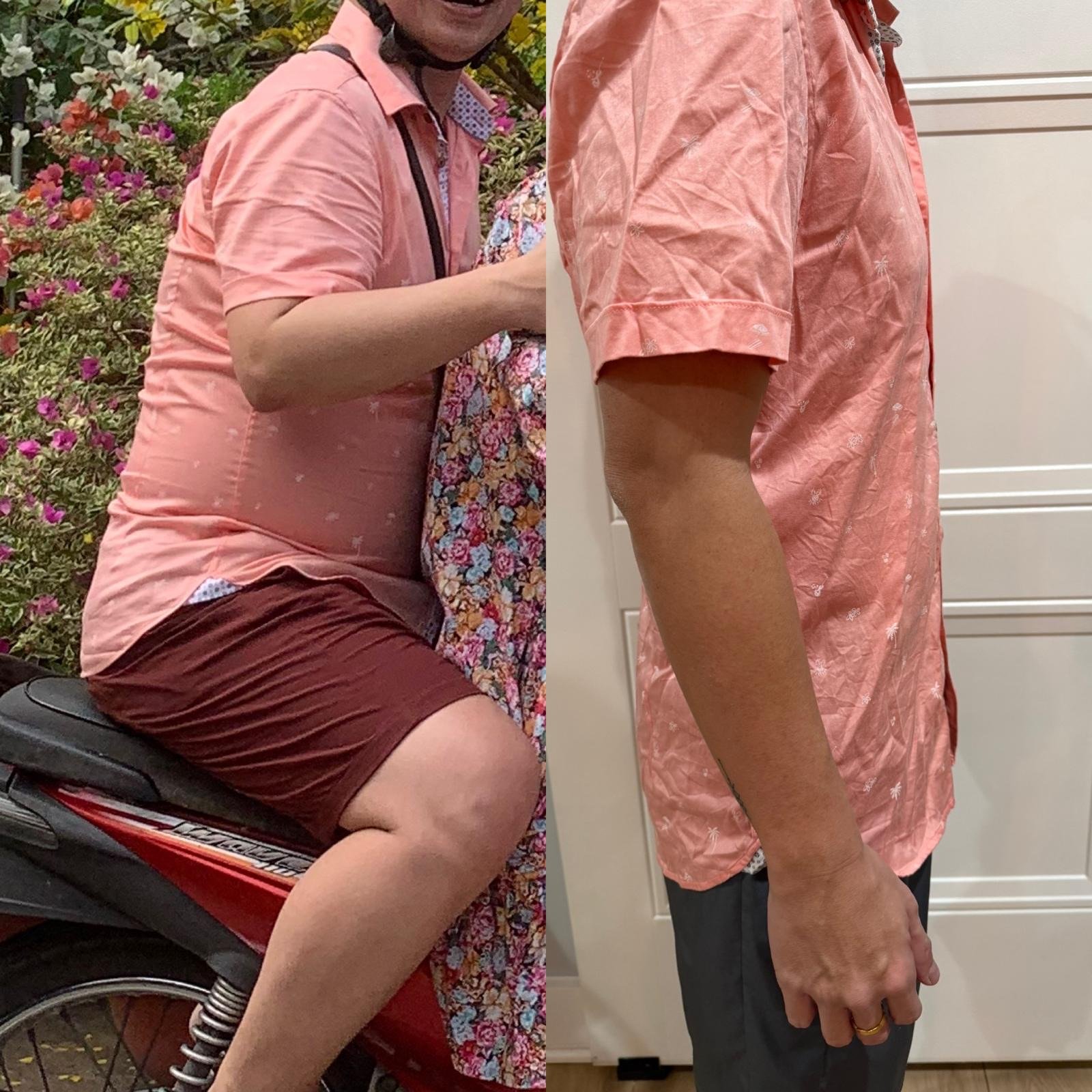 Weight Loss Treatment
