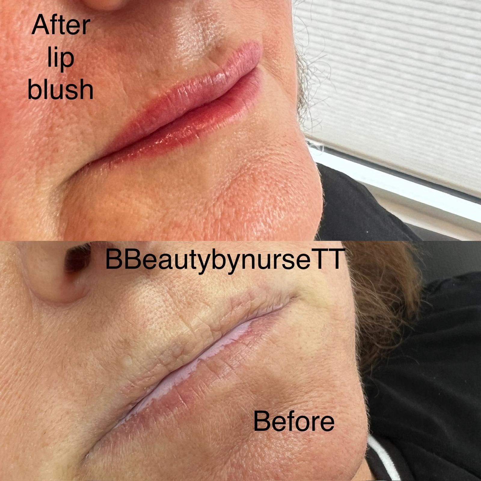 Lip Tattoo: Before & After
