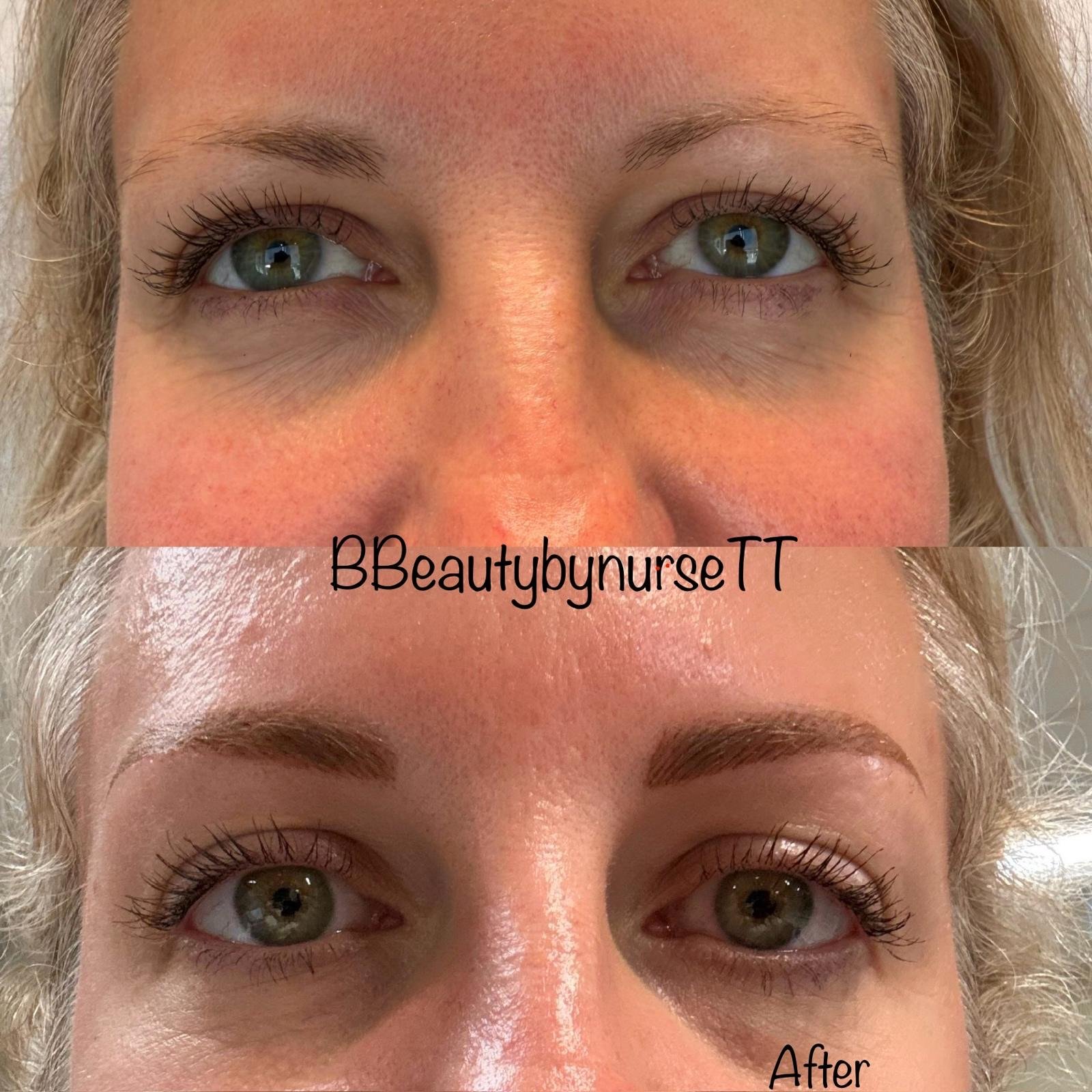 Eyebrow Tattoo: Before & After