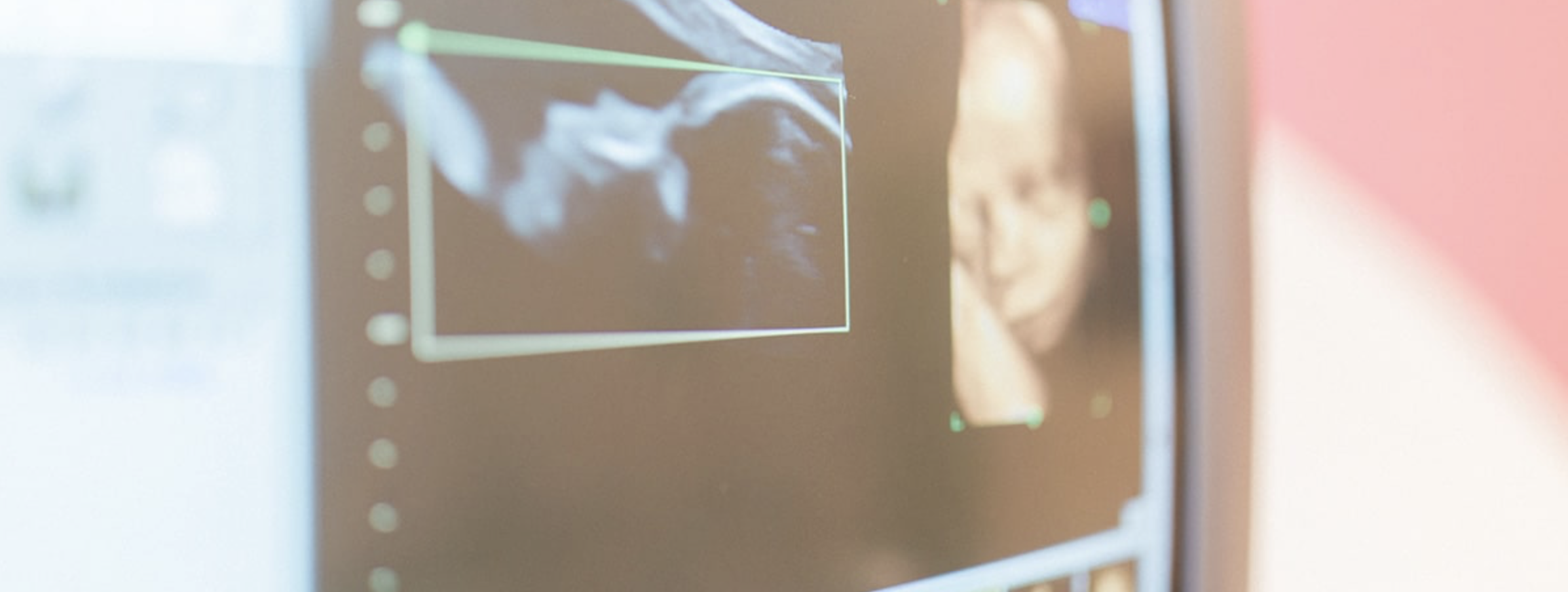 Ein Bildschirm zeigt eine medizinische Ultraschallaufnahme, im Hintergrund ist eine lachende Frau sichtbar.